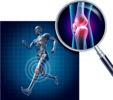 Kniegelenks -Osteoarthritis