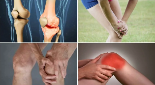 die Symptome der osteoarthritis