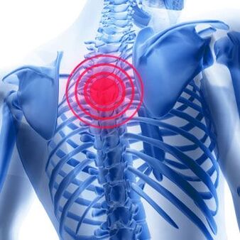 Brustschmerzen mit thorakaler Osteochondrose