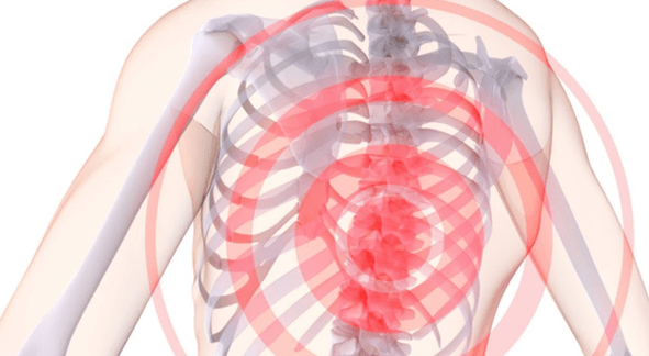 Schmerzen in der Wirbelsäule mit thorakaler Osteochondrose